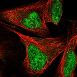 SIX4 Antibody, Novus Biologicals 0.1mL; Unlabeled:Antibodies, Polyclonal